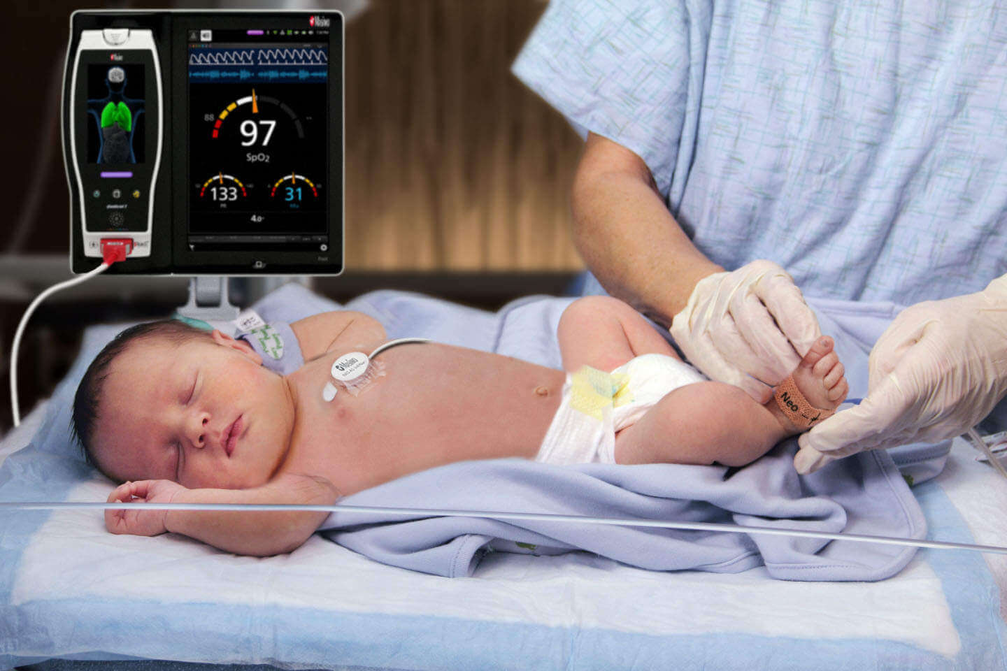 Tamizaje neonatal cardiológico precio